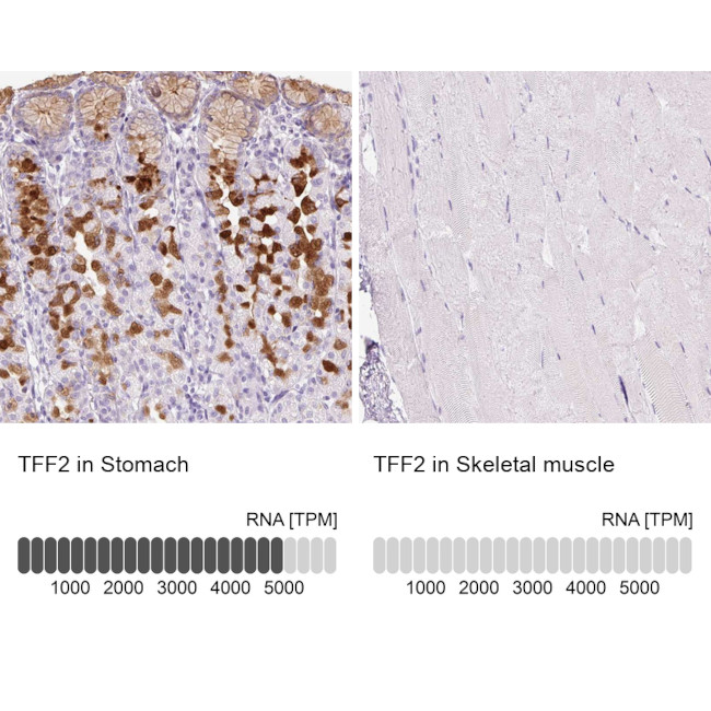 TFF2 Antibody