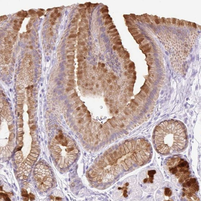 TFF2 Antibody in Immunohistochemistry (IHC)