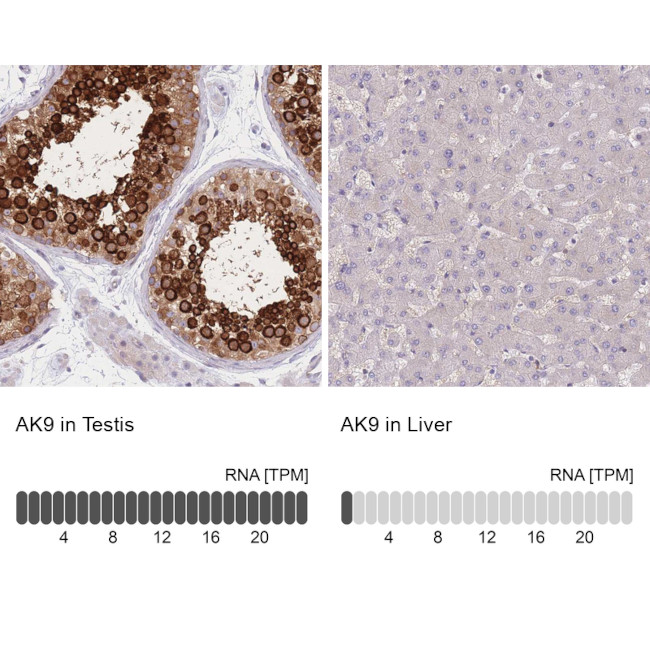 Adenylate Kinase 9 Antibody in Immunohistochemistry (IHC)