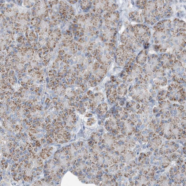 INTU Antibody in Immunohistochemistry (IHC)