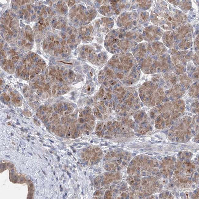 PTGR1 Antibody in Immunohistochemistry (IHC)