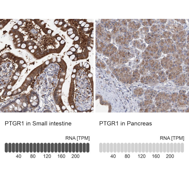 PTGR1 Antibody