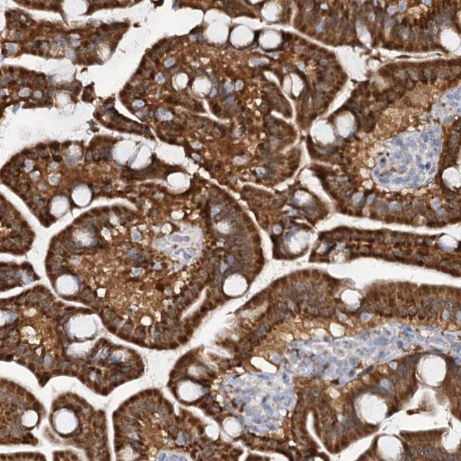 PTGR1 Antibody in Immunohistochemistry (IHC)