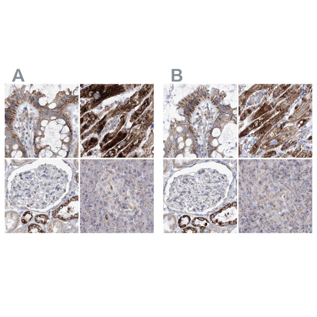 PDHB Antibody in Immunohistochemistry (IHC)