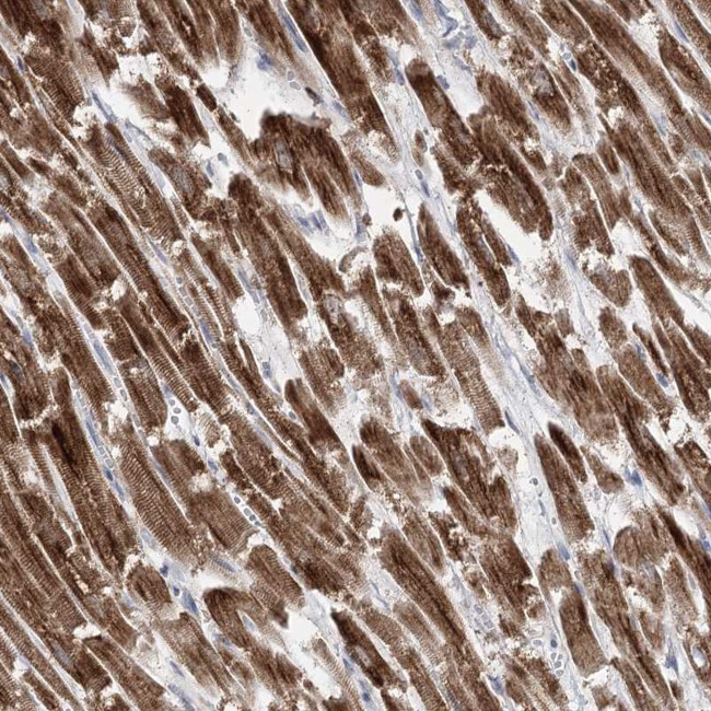 PDHB Antibody in Immunohistochemistry (IHC)