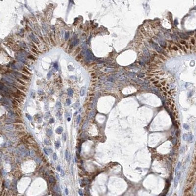 PDHB Antibody in Immunohistochemistry (IHC)