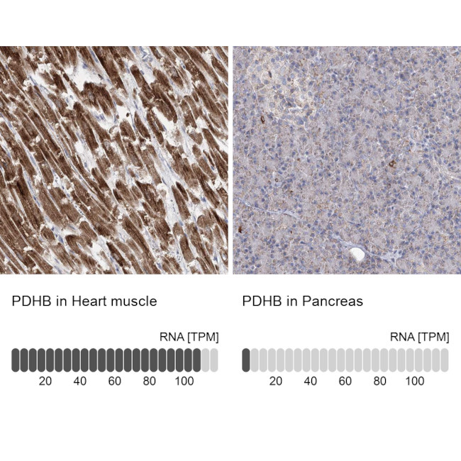 PDHB Antibody