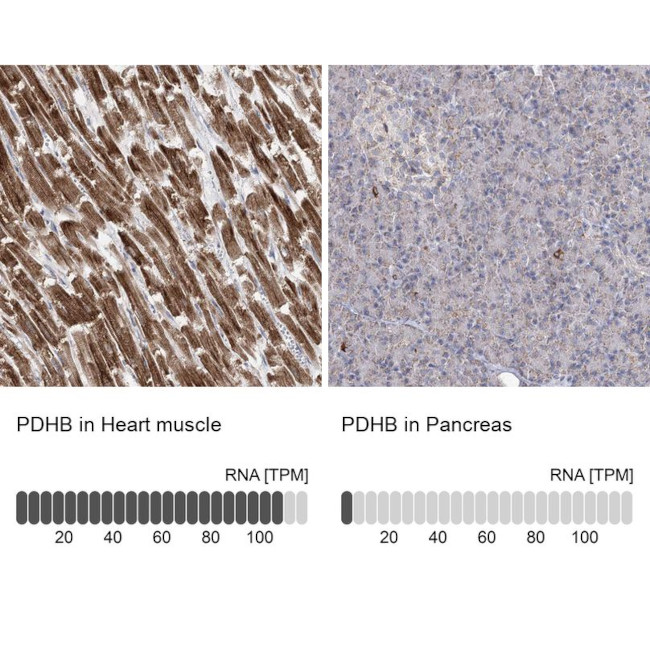 PDHB Antibody