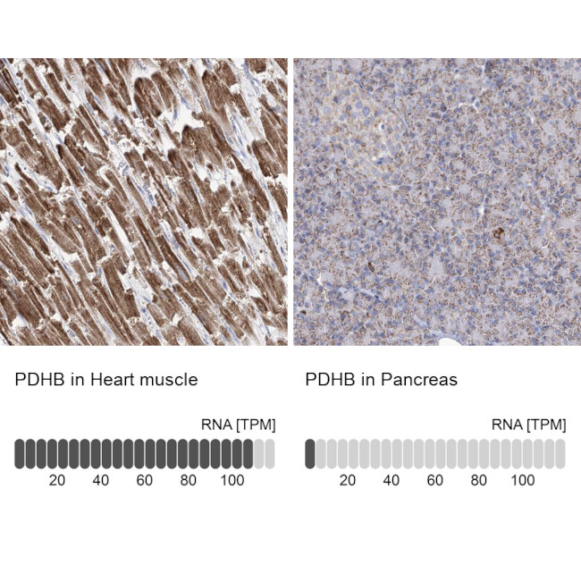 PDHB Antibody in Immunohistochemistry (IHC)