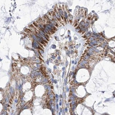 PDHB Antibody in Immunohistochemistry (IHC)