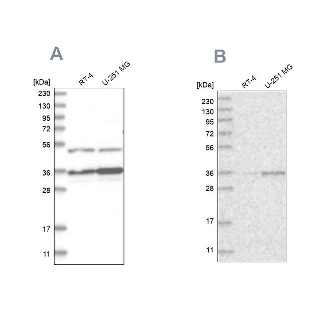 PDHB Antibody in Western Blot (WB)