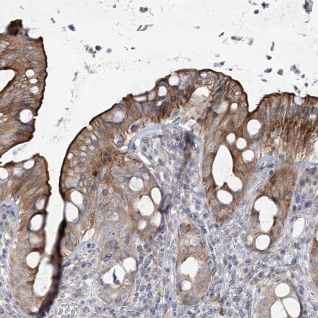 SCN11A Antibody in Immunohistochemistry (IHC)