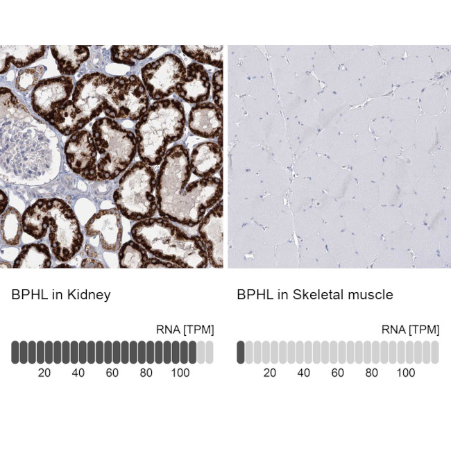 BPHL Antibody in Immunohistochemistry (IHC)