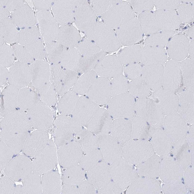 BPHL Antibody in Immunohistochemistry (IHC)