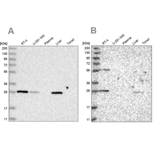 BPHL Antibody in Western Blot (WB)