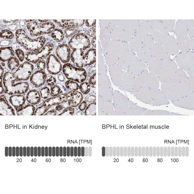 BPHL Antibody in Immunohistochemistry (IHC)