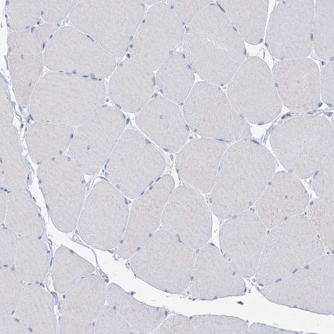 BPHL Antibody in Immunohistochemistry (IHC)