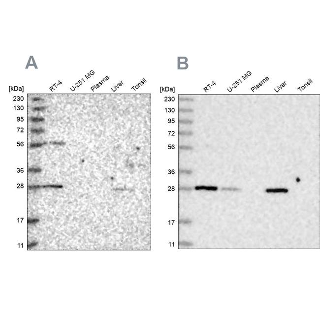 BPHL Antibody in Western Blot (WB)