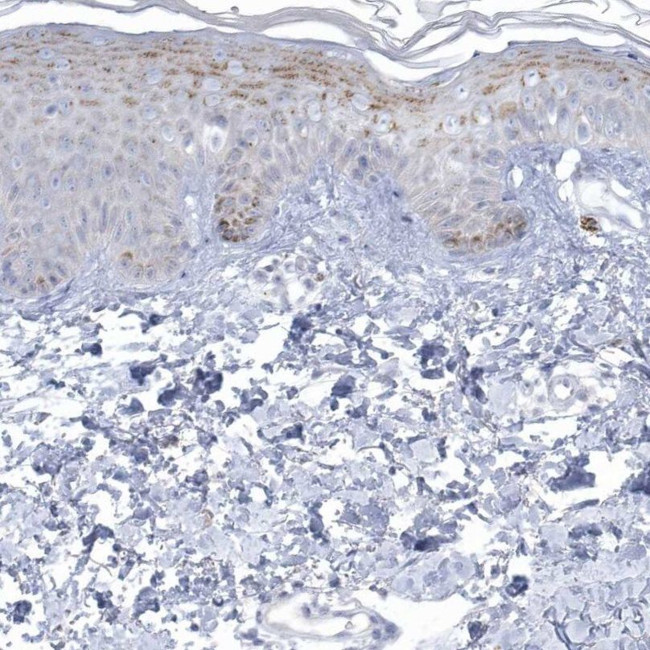 NIPAL1 Antibody in Immunohistochemistry (IHC)