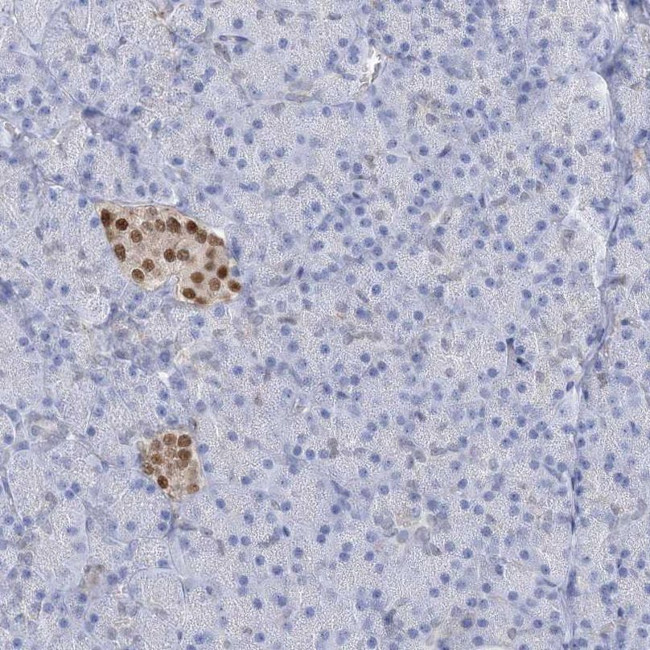 Nkx6.1 Antibody in Immunohistochemistry (IHC)