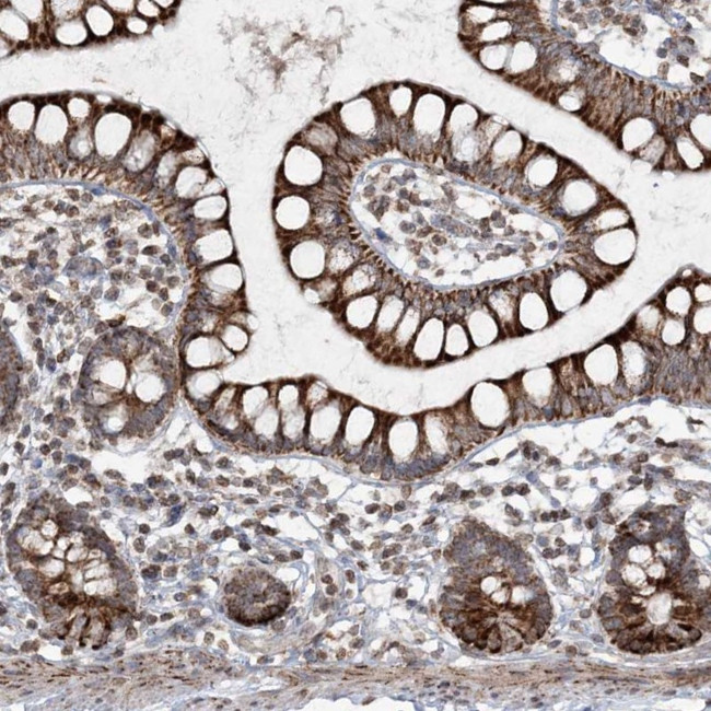 TTC7A Antibody in Immunohistochemistry (IHC)