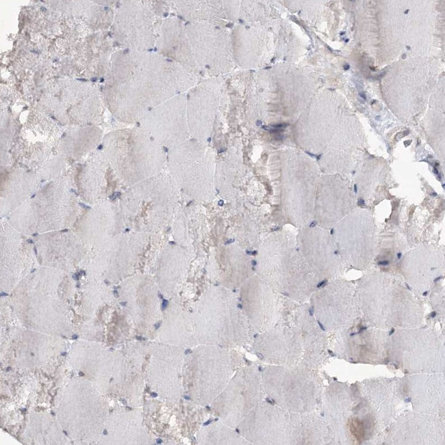 TTC7A Antibody in Immunohistochemistry (IHC)