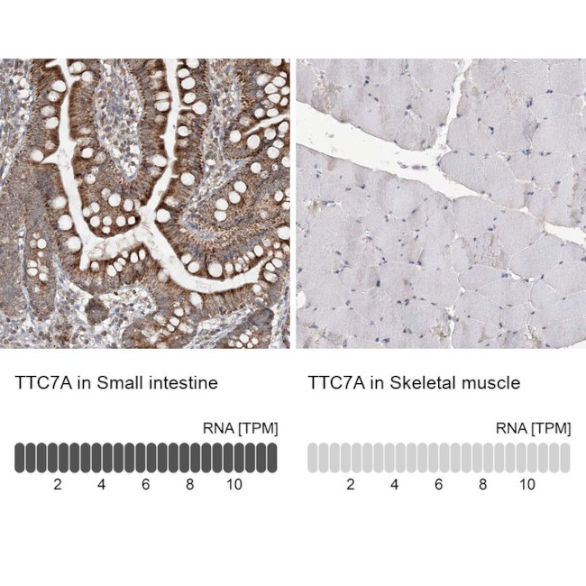 TTC7A Antibody