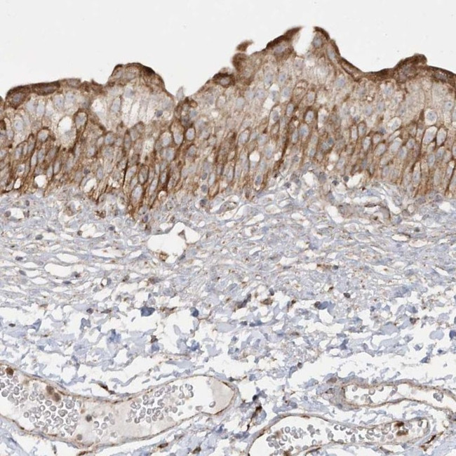 SH3BP2 Antibody in Immunohistochemistry (IHC)