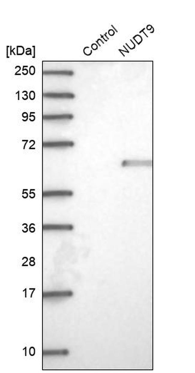 NUDT9 Antibody in Western Blot (WB)