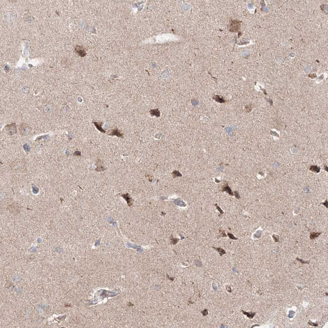 OPA1 Antibody in Immunohistochemistry (IHC)