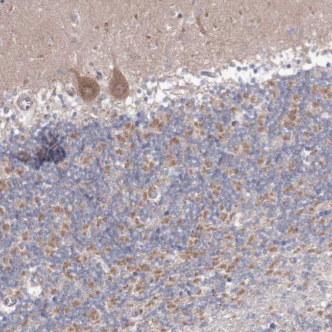 OPA1 Antibody in Immunohistochemistry (IHC)