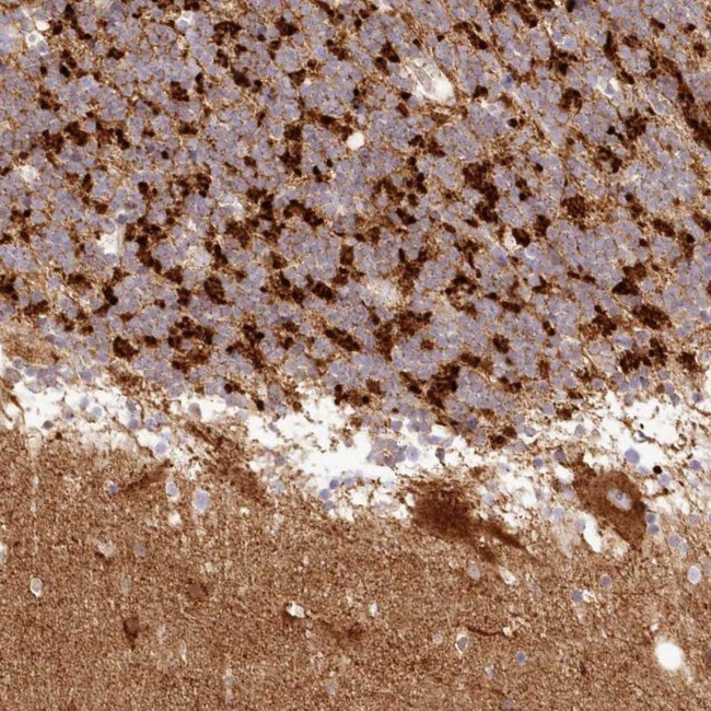 TBC1D14 Antibody in Immunohistochemistry (IHC)