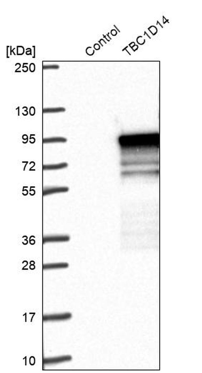 TBC1D14 Antibody in Western Blot (WB)