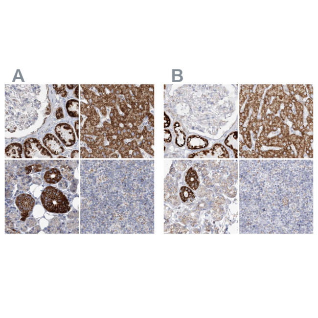 PCCB Antibody in Immunohistochemistry (IHC)