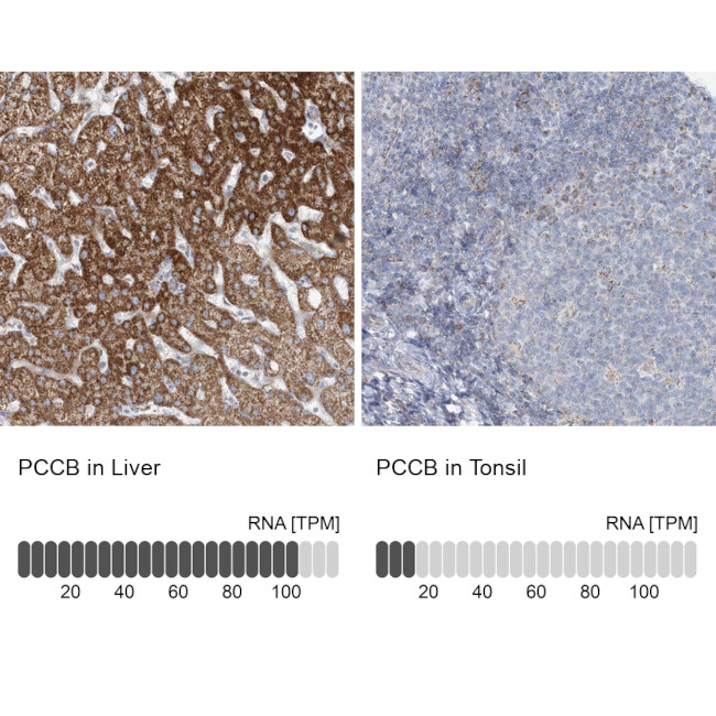 PCCB Antibody