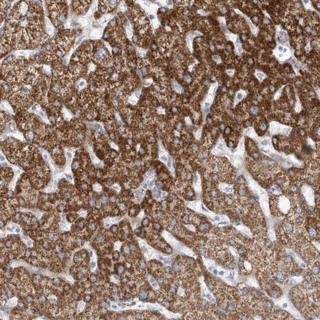 PCCB Antibody in Immunohistochemistry (IHC)