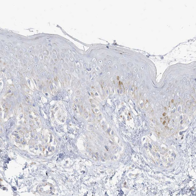 PCCB Antibody in Immunohistochemistry (IHC)