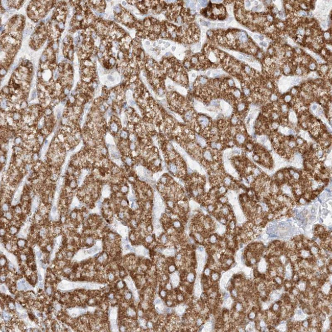 PCCB Antibody in Immunohistochemistry (IHC)