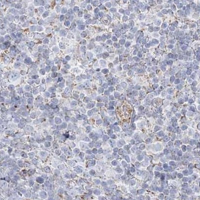 PCCB Antibody in Immunohistochemistry (IHC)