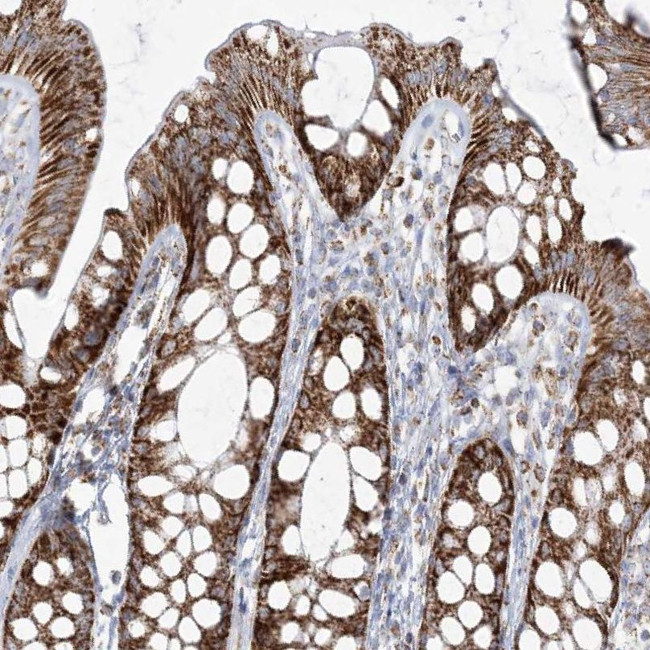 PCCB Antibody in Immunohistochemistry (IHC)