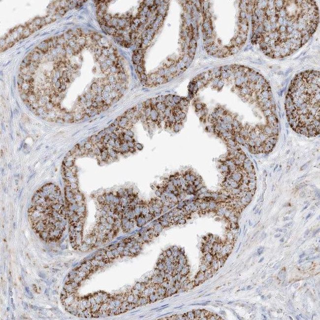 PCCB Antibody in Immunohistochemistry (IHC)