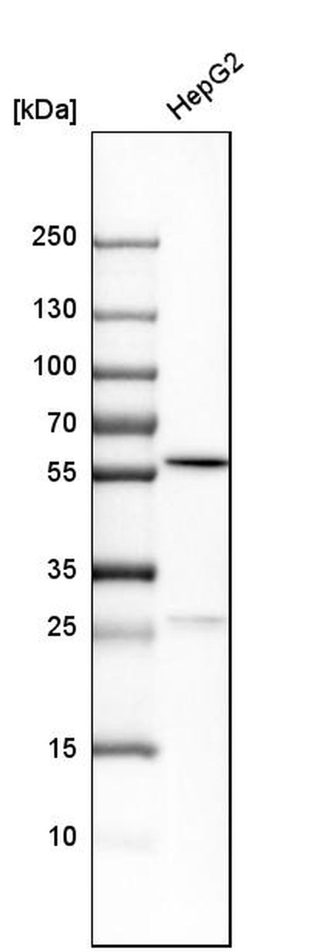 PCCB Antibody in Western Blot (WB)