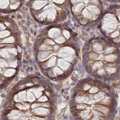 BITE Antibody in Immunohistochemistry (IHC)