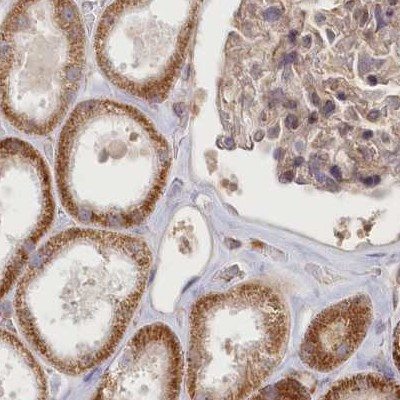 BITE Antibody in Immunohistochemistry (IHC)