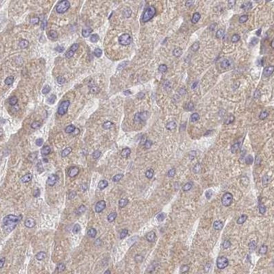 BITE Antibody in Immunohistochemistry (IHC)