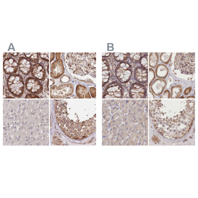 BITE Antibody in Immunohistochemistry (IHC)