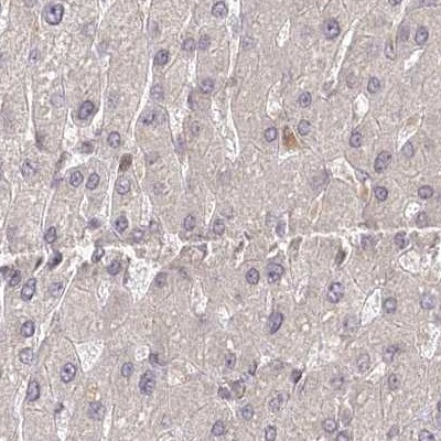 BITE Antibody in Immunohistochemistry (IHC)