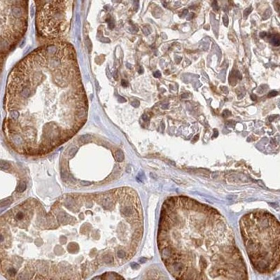 BITE Antibody in Immunohistochemistry (IHC)