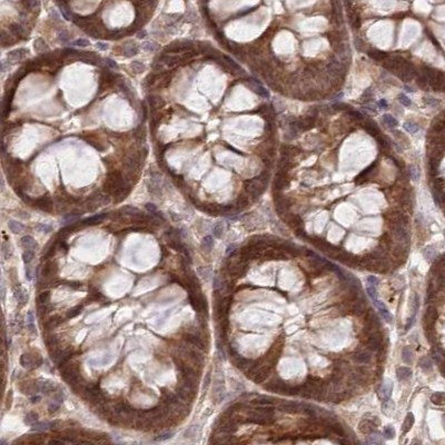 BITE Antibody in Immunohistochemistry (IHC)