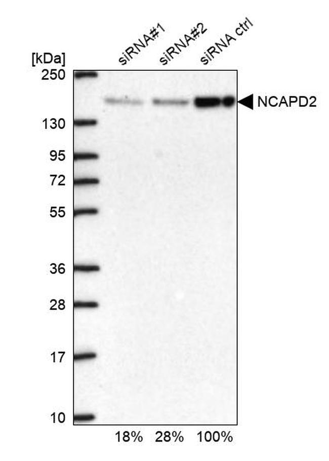 NCAPD2 Antibody in Western Blot (WB)